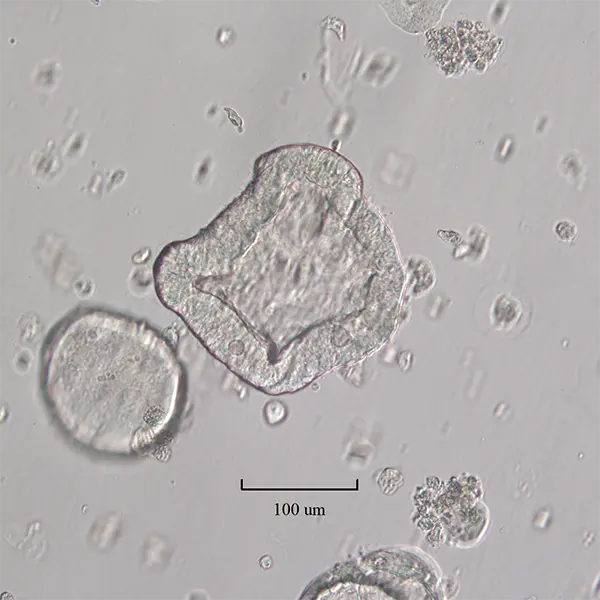 Human small intestine derived organoids